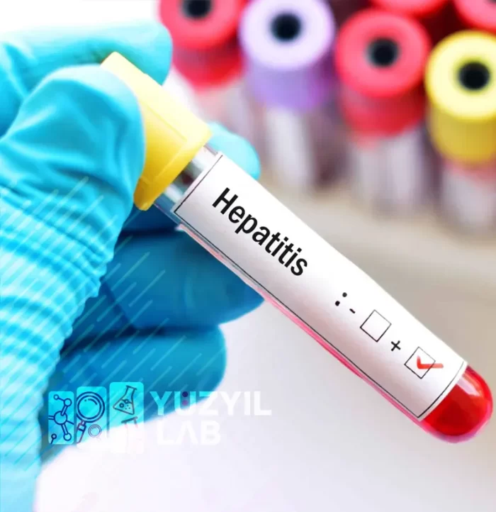 Hepatit Paneli Ankara Laboratuvar